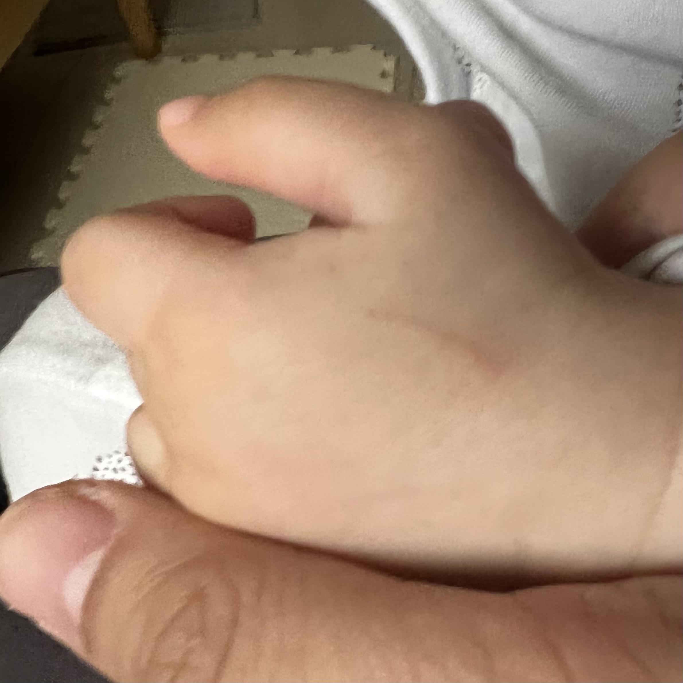[請益]彰化嬰兒抓傷疤痕診所/醫師