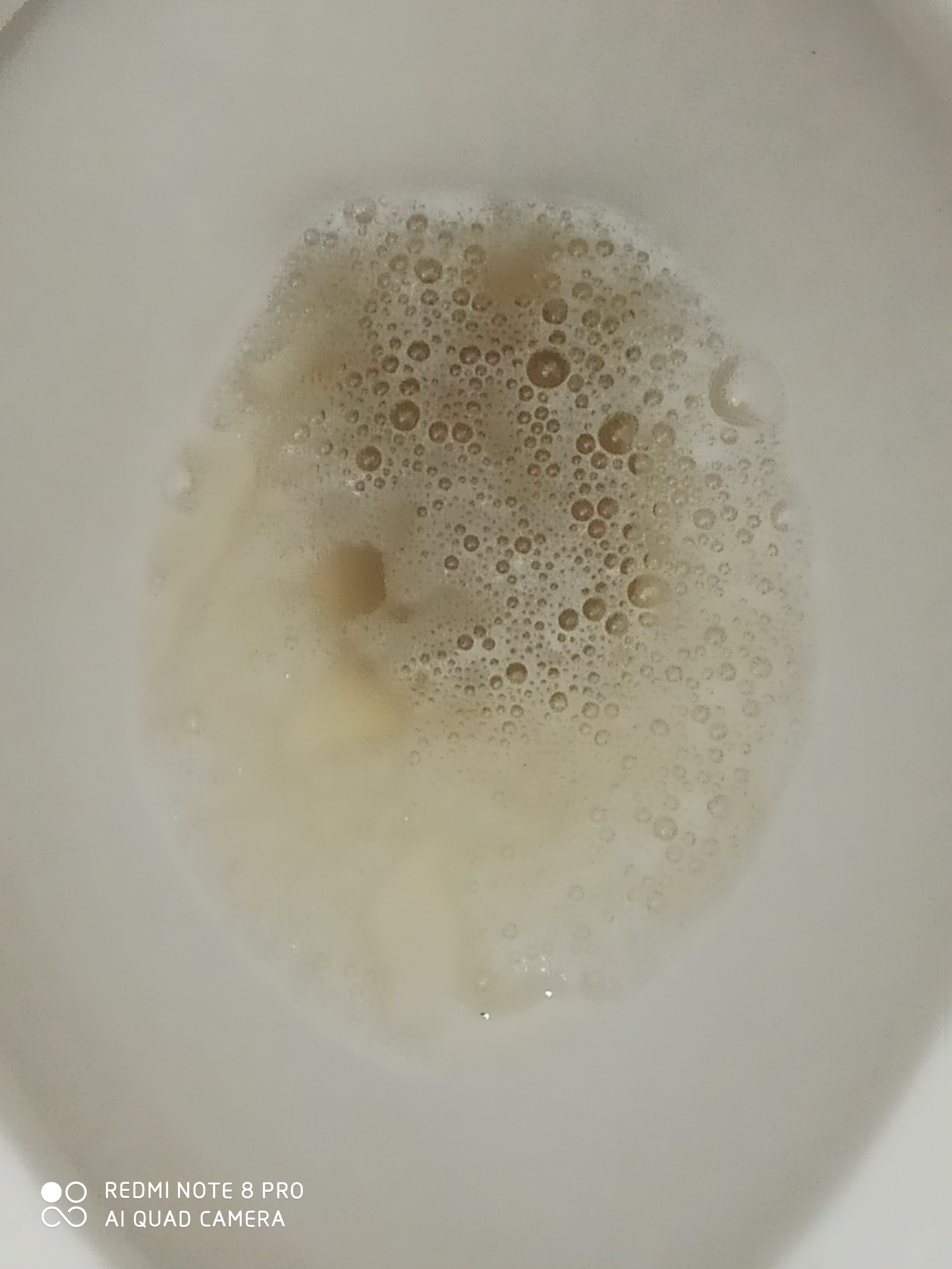 I have had bubbles in urine for four consecutive months, and the